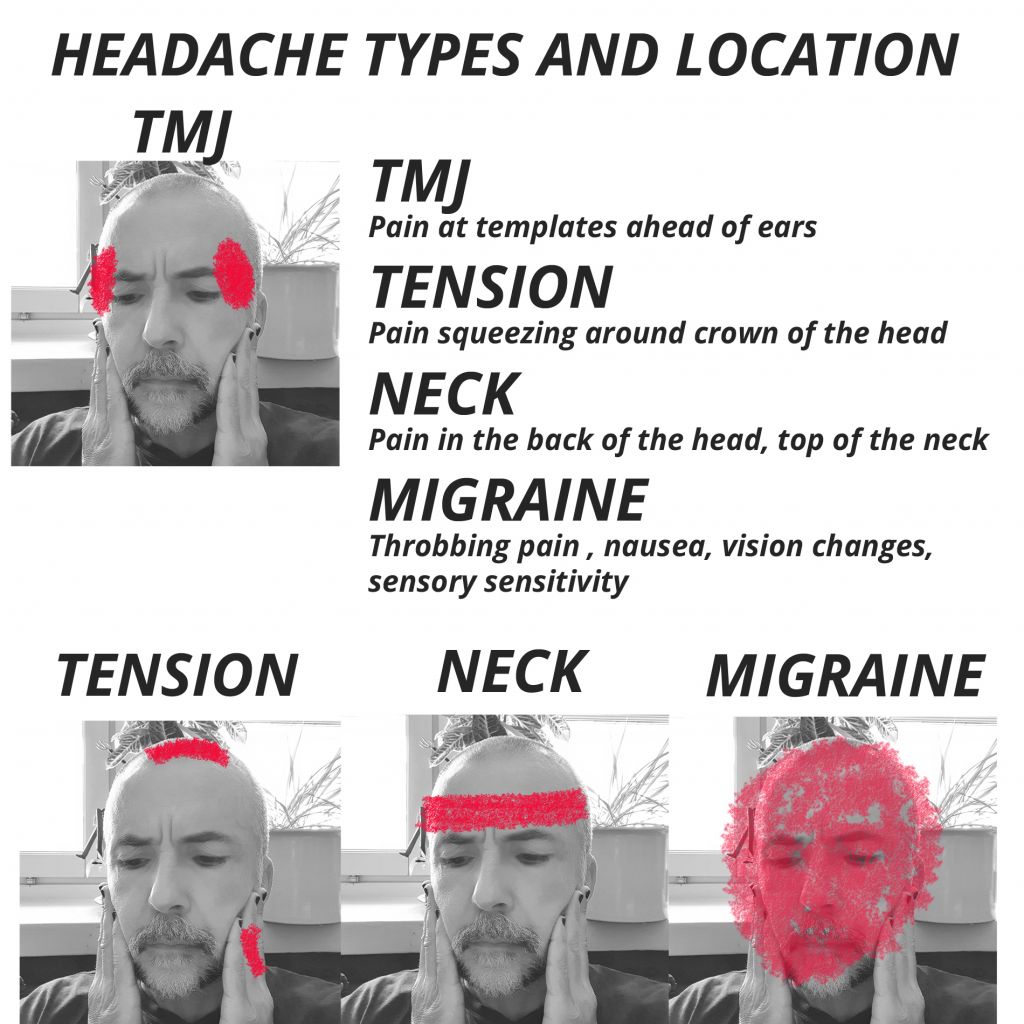 Headache And Migraine